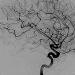 3-angiography
